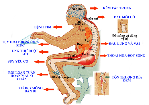 Đứng lên tập thể dục sẽ giúp bạn thoát khỏi bệnh tật